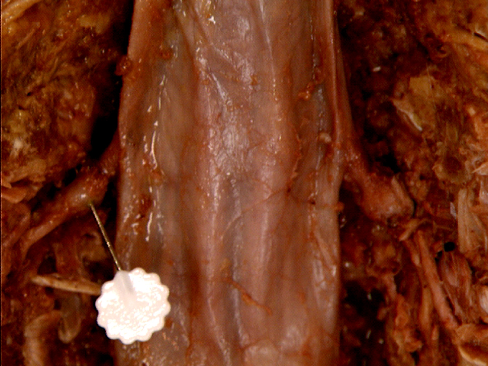 The Body Online - Stony Brook University Department of Anatomy