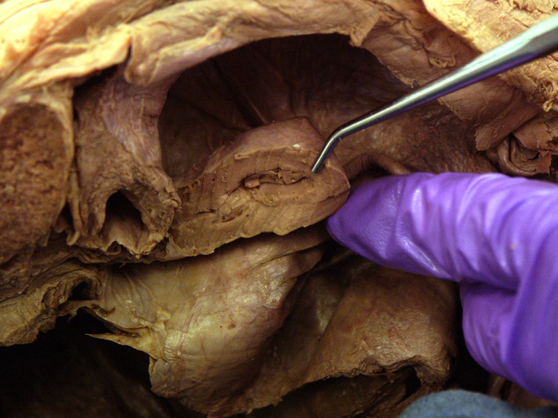 The Body Online - Stony Brook University Department of Anatomy