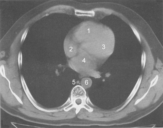 chest ct what does it show